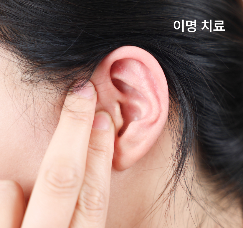 이명 치료